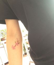 手臂-新肤洗纹身