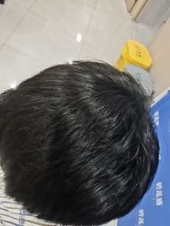 -碧莲盛不剃发植发