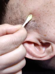 -痣清宫祛斑祛痣连锁店