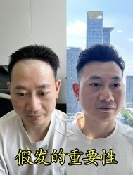 -唐风采假发补发定制