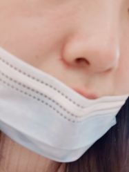 体验前-南京康美美容医院·旗舰店