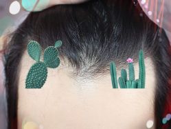 -大麦微针植发全国连锁