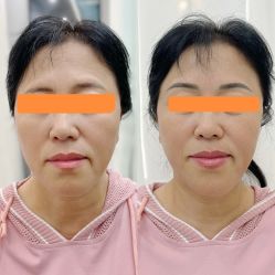 -久匠·纹眉纹绣半永久