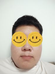 体验后-新地崔劲松医疗美容