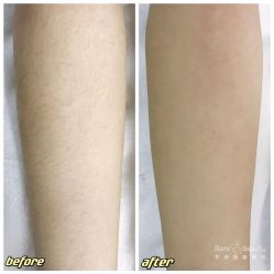 -植蔻妍倍儿专业脱毛·皮肤管理