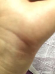 -痣清宫祛斑祛痣连锁店