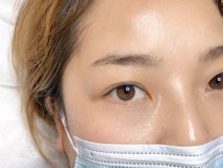 -德绣·机器野生眉发际线·美瞳线半永久