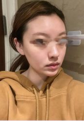 -成都军建医院·疤痕诊疗中心