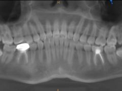 -齐玉齿科JADENTAL