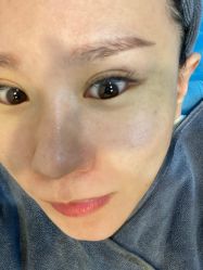 -More摩尔医美の注射线雕光电中心