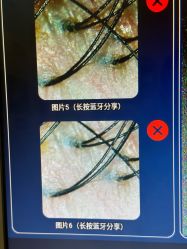 -龄斓·问题肌精准护理