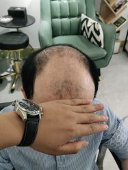 -发饰美男士增发补发假发定制店