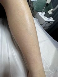 -植蔻妍倍儿专业脱毛·皮肤管理