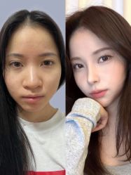 -深圳艺星医疗美容医院