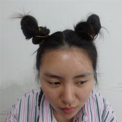-碧莲盛·不剃发植发