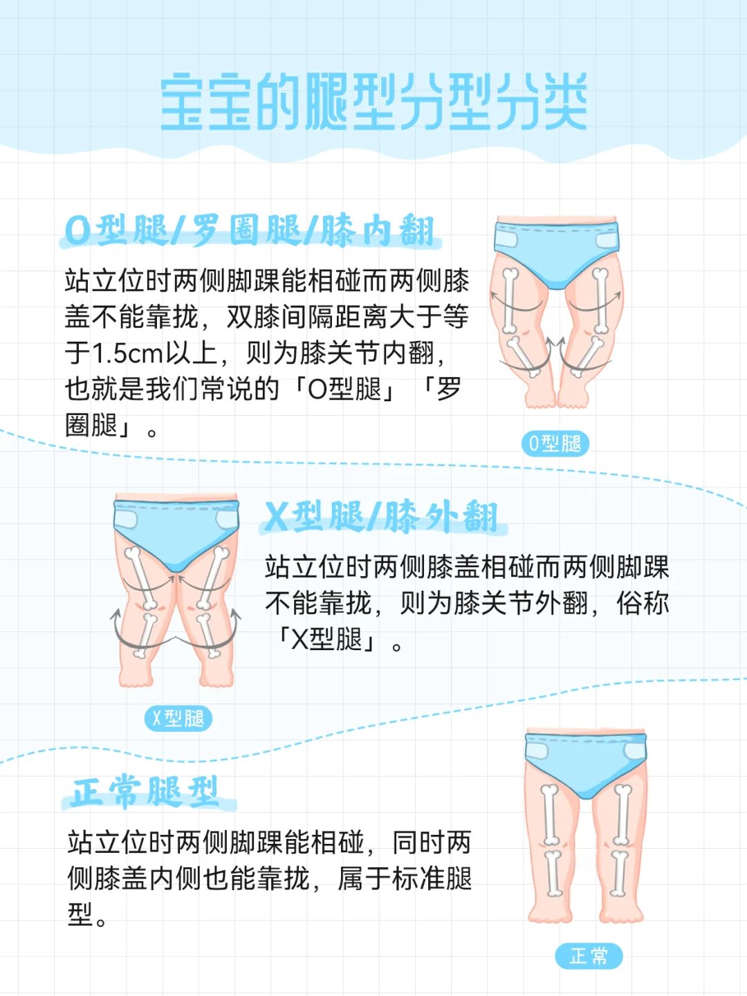 宝宝腿型发育过程图片