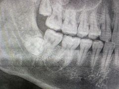 -四川大学华西口腔医院(华西院区)