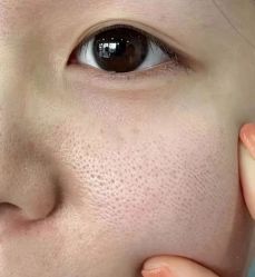 -痘庄科学祛痘国际连锁