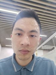 体验后-素美医疗美容·西南眼鼻整形·修复基地