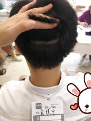 -大麦微针植发丨全国连锁