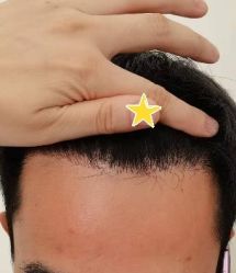 -大麦微针植发丨全国连锁