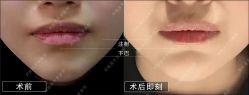 -北京丽星翼美医疗美容
