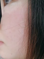 -广州美莱医疗美容医院