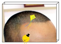 -大麦微针植发全国连锁