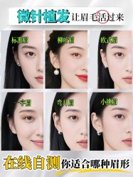 -大麦微针植发全国连锁