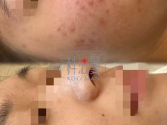 -上置·美兰优湖