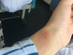 -重庆医科大学附属第一医院(本部)