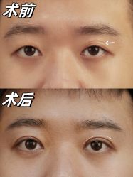 -深圳艺星医疗美容医院