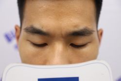 -大麦微针植发丨全国连锁