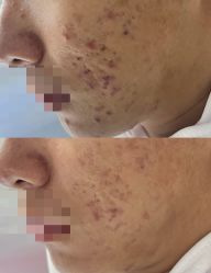 -康美贞·痘肌养护管理中心