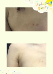 -洁铭新加坡医美