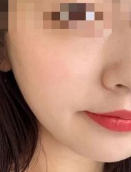 -广州曙光医学美容医院