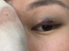 -浙江大学医学院附属第二医院眼科中心