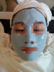 -荟草堂专业祛斑祛痘