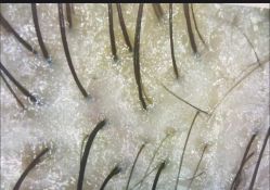 点击看大图 -Bollins波林丝•专研护发中心