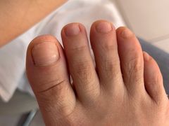 -新甲连锁灰指甲·甲沟炎·鸡眼(黑龙江路店)