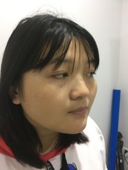 点击看大图 体验前-北京炫美医疗美容