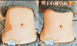 点击看大图 -Lily纤美·科技减脂中心