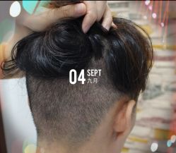 -大麦微针植发全国连锁