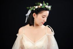 点击看大图 -大麦微针植发丨全国连锁