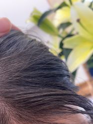 -熙朵美学植发连锁