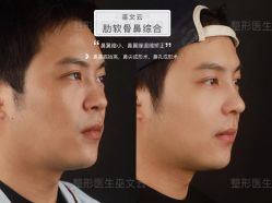 -北京米扬丽格医疗美容·联合丽格鼻整形中心