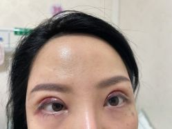 -长沙雅美医疗美容医院