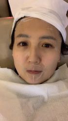 体验后-Dr.U博士医疗美容医院