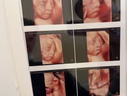 -杭州贝瑞斯美华妇儿医院·早孕·产检·儿科