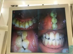 -赫尔森口腔·牙齿种植修复